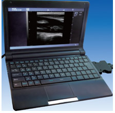 Jual Alat  USG  Portable Mesin USG  DIgital Ultrasonografi 